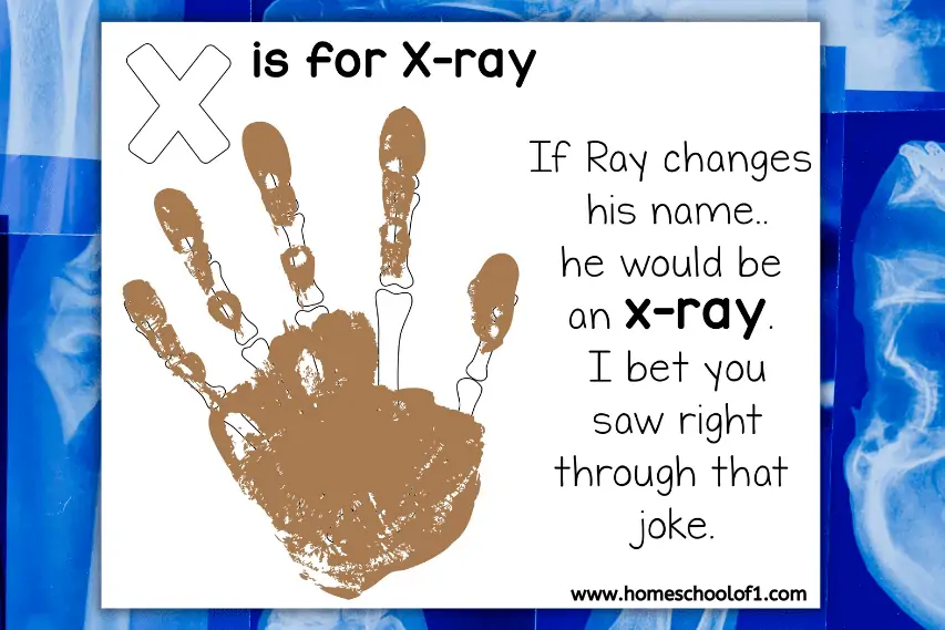 x-ray handprint