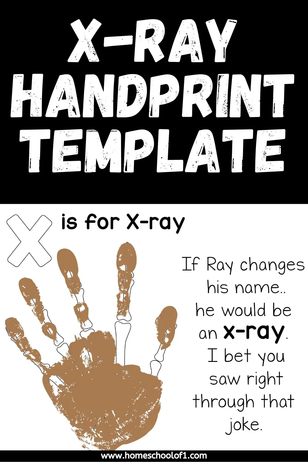 x-ray handprint